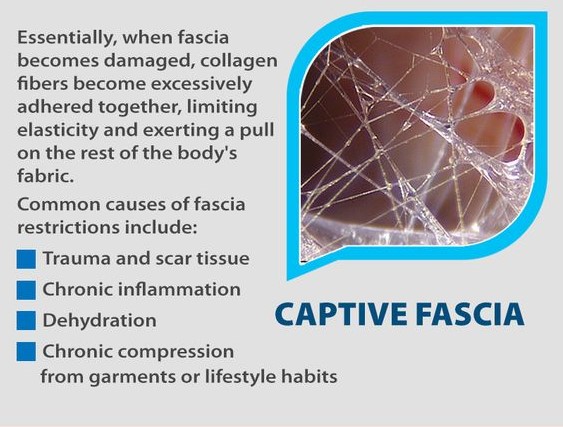 Fascia's Role in Stiffness, Tightness & Pain